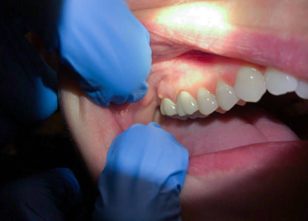 Best Emergency Cosmetic Dentistry in Mount Pleasant, MI