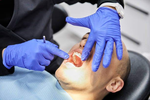 Best Emergency Dentist for Lost Fillings or Crowns in Mount Pleasant, MI